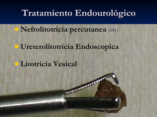 Tratamiento Endourológico <ul><li>Nefrolitotricia percutanea  (NPL) </li></ul><ul><li>Ureterolitotricia Endoscopica </li><...