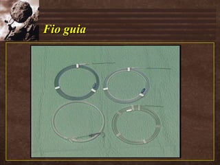 Fio guia 