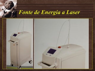 Fonte de Energia a Laser 