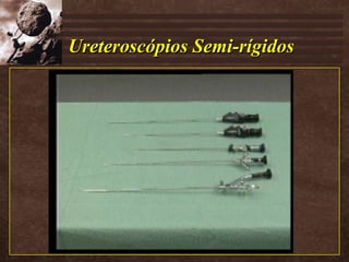 Ureteroscópios Semi-rígidos 