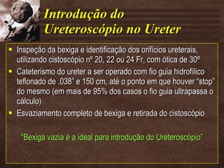 Introdução do Ureteroscópio no Ureter Inspeção da bexiga e identificação dos orifícios ureterais, utilizando cistoscópio nº 20, 22 ou 24 Fr, com ótica de 30º Cateterismo do ureter a ser operado com fio guia hidrofílico teflonado de .038” e 150 cm, até o ponto em que houver “stop” do mesmo (em mais de 95% dos casos o fio guia ultrapassa o cálculo) Esvaziamento completo de bexiga e retirada do cistoscópio “ Bexiga vazia é a ideal para introdução do Ureteroscópio” 