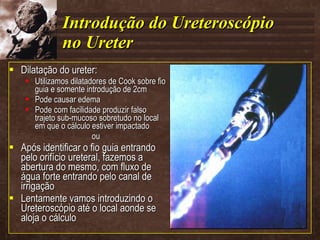 Introdução do Ureteroscópio no Ureter Dilatação do ureter: Utilizamos dilatadores de Cook sobre fio guia e somente introdução de 2cm Pode causar edema Pode com facilidade produzir falso trajeto sub-mucoso sobretudo no local em que o cálculo estiver impactado ou Após identificar o fio guia entrando pelo orifício ureteral, fazemos a abertura do mesmo, com fluxo de água forte entrando pelo canal de irrigação Lentamente vamos introduzindo o Ureteroscópio até o local aonde se aloja o cálculo 