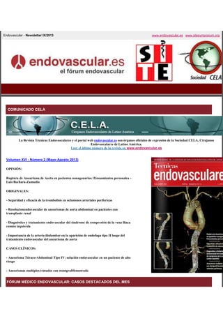 Endovascular - Newsletter IX/2013

www.endovascular.es www.sitesymposium.org

COMUNICADO CELA

La Revista Técnicas Endovasculares y el portal web endovascular.es son órganos oficiales de expresión de la Sociedad CELA, Cirujanos
Endovasculares de Latino América.
Leer el último número de la revista en www.endovascular.es

Volumen XVI - Número 2 (Mayo-Agosto 2013)
OPINIÓN:
Ruptura de Aneurisma de Aorta en pacientes nonagenarios: Pensamientos personales Luis Bechara-Zamudio
ORIGINALES:
- Seguridad y eficacia de la trombolisis en oclusiones arteriales perifericas
- Resolucionendovascular de aneurismas de aorta abdominal en pacientes con
transplante renal
- Diagnóstico y tratamiento endovascular del sindrome de compresión de la vena iliaca
común izquierda
- Importancia de la arteria iliolumbar en la aparición de endofuga tipo II luego del
tratamiento endovascular del aneurisma de aorta
CASOS CLÍNICOS:
- Aneurisma Tóraco-Abdominal Tipo IV: solución endovascular en un paciente de alto
riesgo
- Aneurismas multiples tratados con stentgraftfenestrado

FÓRUM MÉDICO ENDOVASCULAR: CASOS DESTACADOS DEL MES

 