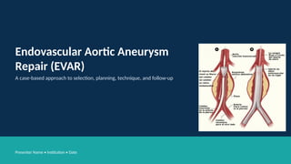 Comprehensive Case-Based Guide to Endovascular Aortic Aneurysm Repair ...