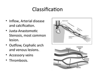 Classification
• Inflow, Arterial disease
and calcification.
• Juxta-Anastomotic
Stenosis, most common
lesion.
• Outflow, Cephalic arch
and venous lesions.
• Accessory veins
• Thrombosis.
 