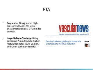 PTA
• Sequential Sizing: 4 mm high-
pressure balloons for juxta-
anastomotic lesions; 5–6 mm for
outflow.
• Large-Balloon Strategy: Using
balloons ≥7 mm leads to higher
maturation rates (97% vs. 88%)
and faster catheter-free HD.
 