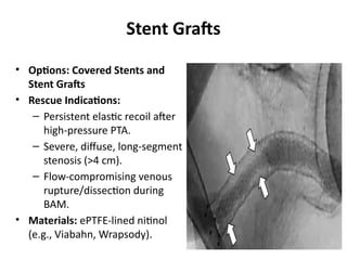 Stent Grafts
• Options: Covered Stents and
Stent Grafts
• Rescue Indications:
– Persistent elastic recoil after
high-pressure PTA.
– Severe, diffuse, long-segment
stenosis (>4 cm).
– Flow-compromising venous
rupture/dissection during
BAM.
• Materials: ePTFE-lined nitinol
(e.g., Viabahn, Wrapsody).
 