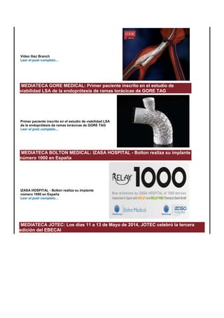 Vídeo Iliac Branch 
Leer el post completo... 
MEDIATECA GORE MEDICAL: Primer paciente inscrito en el estudio de 
viabilidad LSA de la endoprótesis de ramas torácicas de GORE TAG 
Primer paciente inscrito en el estudio de viabilidad LSA 
de la endoprótesis de ramas torácicas de GORE TAG 
Leer el post completo... 
MEDIATECA BOLTON MEDICAL: IZASA HOSPITAL - Bolton realiza su implante 
número 1000 en España 
IZASA HOSPITAL - Bolton realiza su implante 
número 1000 en España 
Leer el post completo... 
MEDIATECA JOTEC: Los días 11 a 13 de Mayo de 2014, JOTEC celebró la tercera 
edición del EBECAI 
 