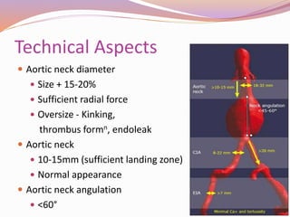 Technical Aspects
 Aortic neck diameter
 Size + 15-20%
 Sufficient radial force
 Oversize - Kinking,
thrombus formn, endoleak
 Aortic neck
 10-15mm (sufficient landing zone)
 Normal appearance
 Aortic neck angulation
 <60°
 