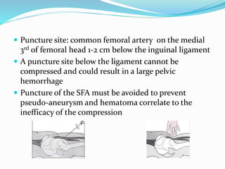  Puncture site: common femoral artery on the medial
3rd of femoral head 1-2 cm below the inguinal ligament
 A puncture site below the ligament cannot be
compressed and could result in a large pelvic
hemorrhage
 Puncture of the SFA must be avoided to prevent
pseudo-aneurysm and hematoma correlate to the
inefficacy of the compression
 