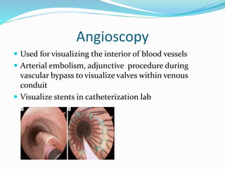 Angioscopy
 Used for visualizing the interior of blood vessels
 Arterial embolism, adjunctive procedure during
vascular bypass to visualize valves within venous
conduit
 Visualize stents in catheterization lab
 