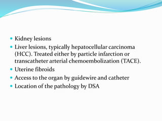  Kidney lesions
 Liver lesions, typically hepatocellular carcinoma
(HCC). Treated either by particle infarction or
transcatheter arterial chemoembolization (TACE).
 Uterine fibroids
 Access to the organ by guidewire and catheter
 Location of the pathology by DSA
 
