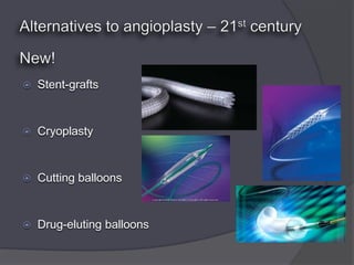    Stent-grafts


   Cryoplasty


   Cutting balloons


   Drug-eluting balloons
 