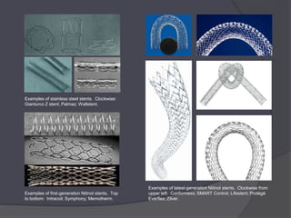 Examples of stainless steel stents. Clockwise:
Gianturco Z stent; Palmaz; Wallstent.




                                                   Examples of latest-generation Nitinol stents. Clockwise from
Examples of first-generation Nitinol stents. Top   upper left: Conformexx; SMART Control; Lifestent; Protégé
to bottom: Intracoil; Symphony; Memotherm.         Everflex; Zilver.
 