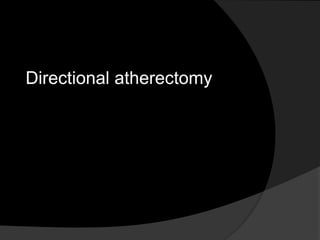 Directional atherectomy
 