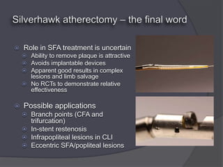    Role in SFA treatment is uncertain
     Ability to remove plaque is attractive
     Avoids implantable devices
     Apparent good results in complex
      lesions and limb salvage
     No RCTs to demonstrate relative
      effectiveness

   Possible applications
     Branch points (CFA and
      trifurcation)
     In-stent restenosis
     Infrapopliteal lesions in CLI
     Eccentric SFA/popliteal lesions
 