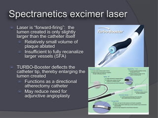    Laser is “forward-firing”: the
    lumen created is only slightly
    larger than the catheter itself
      Relatively small volume of
        plaque ablated
      Insufficient to fully recanalize
        larger vessels (SFA)

   TURBO-Booster deflects the
    catheter tip, thereby enlarging the
    lumen created
      Functions as a directional
        atherectomy catheter
      May reduce need for
        adjunctive angioplasty
 