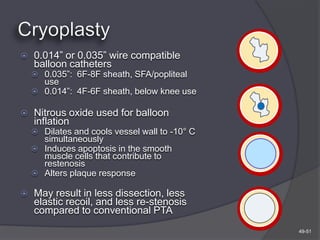    0.014” or 0.035” wire compatible
    balloon catheters
     0.035”: 6F-8F sheath, SFA/popliteal
      use
     0.014”: 4F-6F sheath, below knee use

   Nitrous oxide used for balloon
    inflation
     Dilates and cools vessel wall to -10° C
      simultaneously
     Induces apoptosis in the smooth
      muscle cells that contribute to
      restenosis
     Alters plaque response

   May result in less dissection, less
    elastic recoil, and less re-stenosis
    compared to conventional PTA
                                                49-51
 