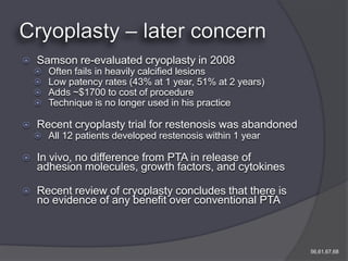    Samson re-evaluated cryoplasty in 2008
       Often fails in heavily calcified lesions
       Low patency rates (43% at 1 year, 51% at 2 years)
       Adds ~$1700 to cost of procedure
       Technique is no longer used in his practice

   Recent cryoplasty trial for restenosis was abandoned
     All 12 patients developed restenosis within 1 year

   In vivo, no difference from PTA in release of
    adhesion molecules, growth factors, and cytokines

   Recent review of cryoplasty concludes that there is
    no evidence of any benefit over conventional PTA



                                                            56,61,67,68
 