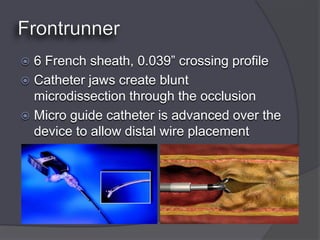  6 French sheath, 0.039” crossing profile
 Catheter jaws create blunt
  microdissection through the occlusion
 Micro guide catheter is advanced over the
  device to allow distal wire placement
 