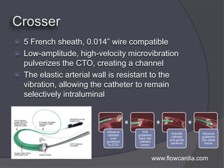    5 French sheath, 0.014” wire compatible
   Low-amplitude, high-velocity microvibration
    pulverizes the CTO, creating a channel
   The elastic arterial wall is resistant to the
    vibration, allowing the catheter to remain
    selectively intraluminal



                            Advance         Pull
                                                      Activate     Advance
                             catheter   guidewire
                                                      catheter    guidewire
                               over     back into
                                                     and gently   into distal
                            guidewire    catheter
                                                      advance       lumen
                             to CTO       lumen



                                                www.flowcardia.com
 