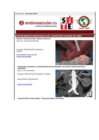 Endovascular - Newsletter X/2015
FÓRUM MÉDICO ENDOVASCULAR: CASOS DESTACADOS DEL MES
Webinar: Fenestrated Graft - Made by Physician
Autor: Dr. Juan Carlos Carbonell
Congreso:SITE CELA 2015, Barcelona -
España
Especialidad:Cirugía vascular
Leer el postcompleto.
"Impossible cannulations in fenestrated/branched endografts: can we leave some fenestrations
unstended?
Autor: Dr. Eric Verhoeven
Congreso:SITE CELA 2015, Barcelona - España
Especialidad:Cirugía Vascular
Leer el postcompleto.
Treatment Pelvic Venous Reflux - Therapeutic Goals and Protocol
 