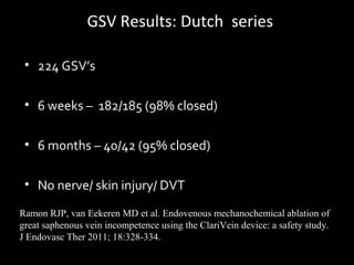 Endovenous ablation new methods where do we go from here | PPT