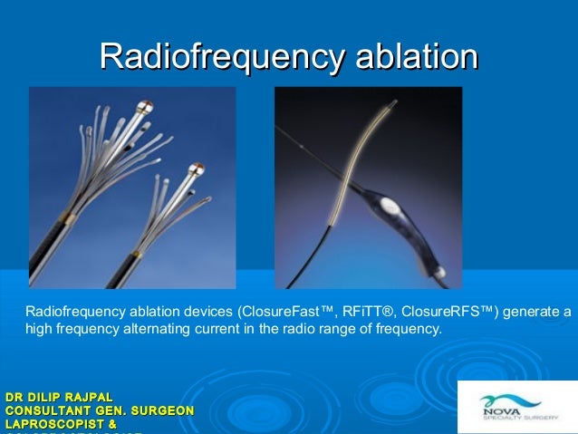 frequency ablation high laser Endovenous ablation frequency ablation high laser Endovenous ablation