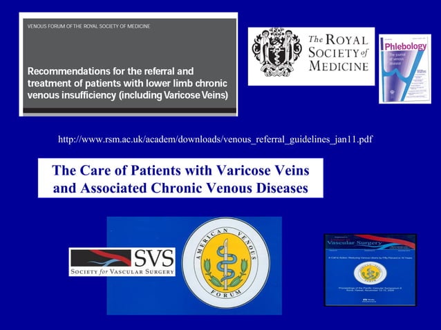 Endovenous or surgical treatment of cvi | PPT