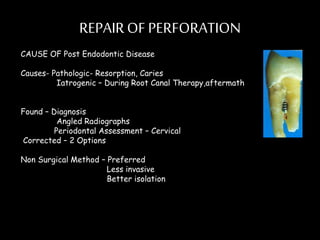 REPAIROF PERFORATION
CAUSE OF Post Endodontic Disease
Causes- Pathologic- Resorption, Caries
Iatrogenic – During Root Canal Therapy,aftermath
Found – Diagnosis
Angled Radiographs
Periodontal Assessment – Cervical
Corrected – 2 Options
Non Surgical Method – Preferred
Less invasive
Better isolation
 