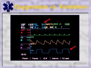 Oxygenation vs. Ventilation


    Car
       bon
       Dio
         xid
             e



                 Carbon Dioxide
 