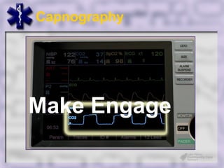 Capnography




Make Engage
 