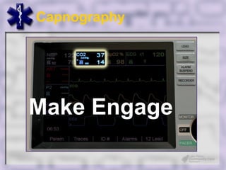 Capnography




Make Engage
 