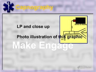 Capnography


LP and close up

Photo illustration of this graphic

Make Engage
 