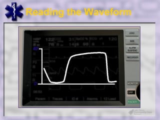 Reading the Waveform
 