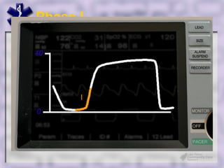 Phase I




Make Engage
 