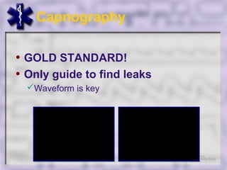 Capnography

• GOLD STANDARD!
• Only guide to find leaks
  Waveform is key
 