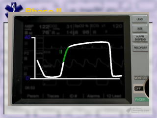 Phase II




Make Engage
 