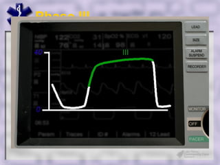 Phase III




Make Engage
 