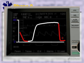 Phase 0




Make Engage
 