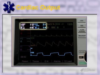 Cardiac Output
 