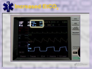 Increased EtCO2
 