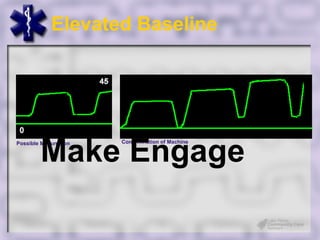 Elevated Baseline




         Make Engage
Possible Malfunction   Contamination of Machine
 