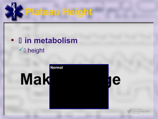 Plateau Height

•  in metabolism
   height




  Make Engage
 