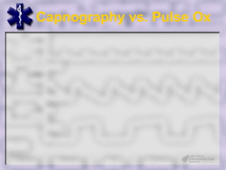 Capnography vs. Pulse Ox
 