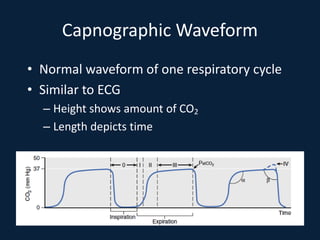 Capnographic Waveform
• Normal waveform of one respiratory cycle
• Similar to ECG
– Height shows amount of CO2
– Length depicts time
 