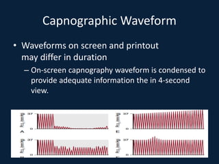 Capnographic Waveform
• Waveforms on screen and printout
may differ in duration
– On-screen capnography waveform is condensed to
provide adequate information the in 4-second
view.
 