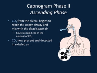 Capnogram Phase II
Ascending Phase
• CO2 from the alveoli begins to
reach the upper airway and
mix with the dead space air
– Causes a rapid rise in the
amount of CO2
• CO2 now present and detected
in exhaled air
Alveoli
 