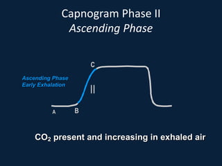 Capnogram Phase II
Ascending Phase
CO2 present and increasing in exhaled air
II
A B
C
Ascending Phase
Early Exhalation
 
