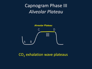 Capnogram Phase III
Alveolar Plateau
CO2 exhalation wave plateaus
A B
C D
III
Alveolar Plateau
 